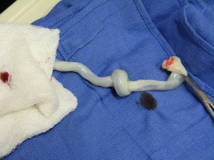 Delayed cord clamping